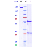 SDS-PAGE - Ravagalimab Biosimilar - Anti-CD40 Antibody - Low endotoxin, Azide free (A323691) - Antibodies.com