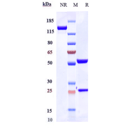SDS-PAGE - Ravulizumab Biosimilar - Anti-C5 Antibody - Low endotoxin, Azide free (A323692) - Antibodies.com