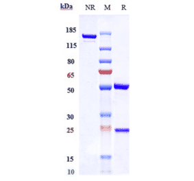 SDS-PAGE - Recaticimab Biosimilar - Anti-PCSK9 Antibody - Low endotoxin, Azide free (A323693) - Antibodies.com