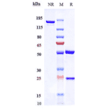 SDS-PAGE - Recaticimab Biosimilar - Anti-PCSK9 Antibody - Low endotoxin, Azide free (A323693) - Antibodies.com
