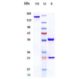 SDS-PAGE - Refanezumab Biosimilar - Anti-MAG/GMA Antibody - Low endotoxin, Azide free (A323694) - Antibodies.com
