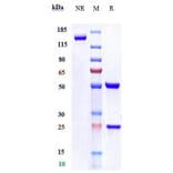 SDS-PAGE - Relatlimab Biosimilar - Anti-LAG-3 Antibody - Low endotoxin, Azide free (A323695) - Antibodies.com