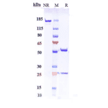 SDS-PAGE - Retifanlimab Biosimilar - Anti-PD1 Antibody - Low endotoxin, Azide free (A323696) - Antibodies.com
