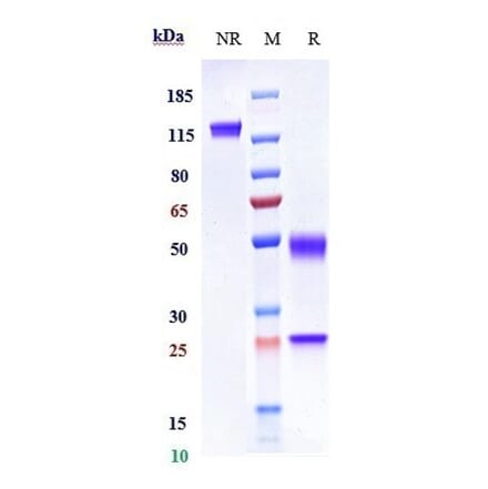 SDS-PAGE - Rilotumumab Biosimilar - Anti-HGF Antibody - Low endotoxin, Azide free (A323698) - Antibodies.com