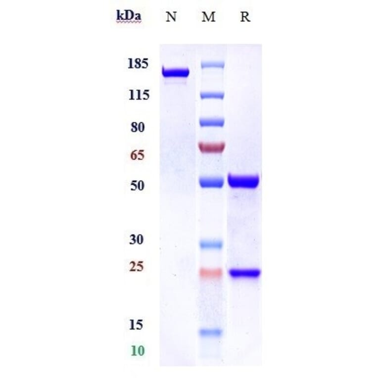 SDS-PAGE - Rinucumab Biosimilar - Anti-PDGFR beta Antibody - Low endotoxin, Azide free (A323699) - Antibodies.com
