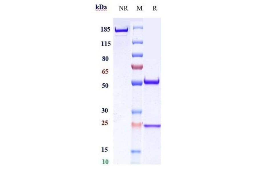 SDS-PAGE - Ripertamab Biosimilar - Anti-CD20 Antibody - Low endotoxin, Azide free (A323700) - Antibodies.com