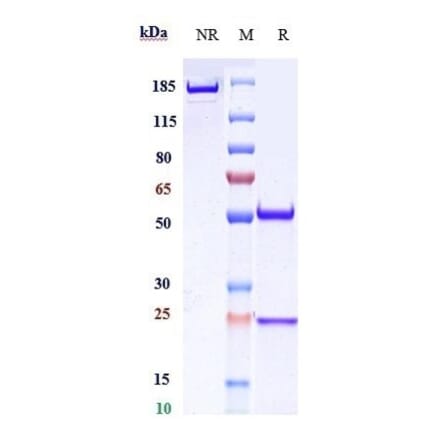 SDS-PAGE - Ripertamab Biosimilar - Anti-CD20 Antibody - Low endotoxin, Azide free (A323700) - Antibodies.com