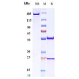 SDS-PAGE - Ripertamab Biosimilar - Anti-CD20 Antibody - Low endotoxin, Azide free (A323700) - Antibodies.com