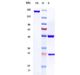 SDS-PAGE - Rituximab Biosimilar - Anti-CD20 Antibody - Low endotoxin, Azide free (A323702) - Antibodies.com