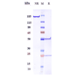 SDS-PAGE - Robatumumab Biosimilar - Anti-IGF1 Receptor Antibody - Low endotoxin, Azide free (A323703) - Antibodies.com