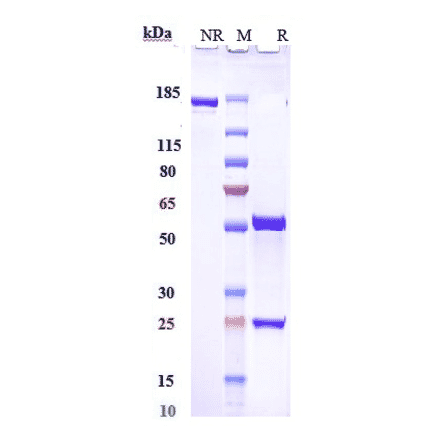 SDS-PAGE - Roledumab Biosimilar - Anti-RhD Antibody - Low endotoxin, Azide free (A323704) - Antibodies.com