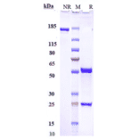 SDS-PAGE - Roledumab Biosimilar - Anti-RhD Antibody - Low endotoxin, Azide free (A323704) - Antibodies.com