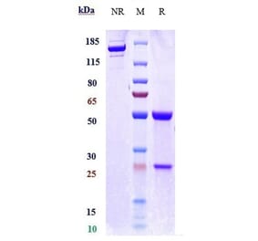 SDS-PAGE - Rontalizumab Biosimilar - Anti-Interferon alpha 1 Antibody - Low endotoxin, Azide free (A323707) - Antibodies.com