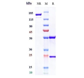 SDS-PAGE - Rosopatamab Biosimilar - Anti-PSMA Antibody - Low endotoxin, Azide free (A323710) - Antibodies.com