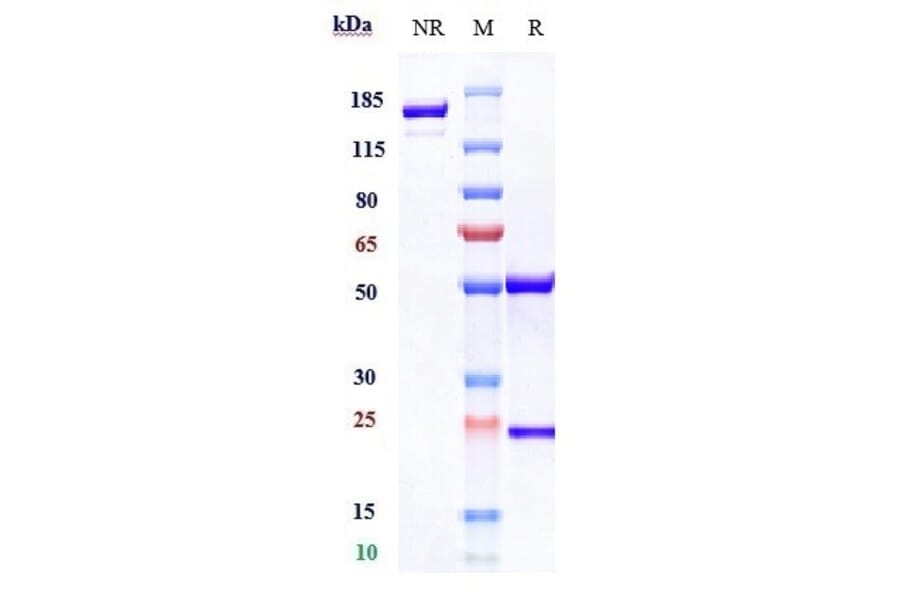 SDS-PAGE - Rosopatamab Biosimilar - Anti-PSMA Antibody - Low endotoxin, Azide free (A323710) - Antibodies.com