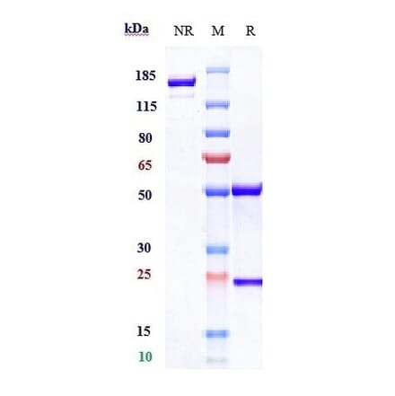 SDS-PAGE - Rosopatamab Biosimilar - Anti-PSMA Antibody - Low endotoxin, Azide free (A323710) - Antibodies.com