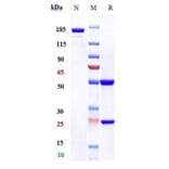 SDS-PAGE - Sabatolimab Biosimilar - Anti-TIM 3 Antibody - Low endotoxin, Azide free (A323715) - Antibodies.com