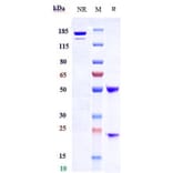 SDS-PAGE - Samrotamab Biosimilar - Anti-LRRC15 Antibody - Low endotoxin, Azide free (A323720) - Antibodies.com