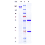 SDS-PAGE - Secukinumab Biosimilar - Anti-IL-17A Antibody - Low endotoxin, Azide free (A323724) - Antibodies.com