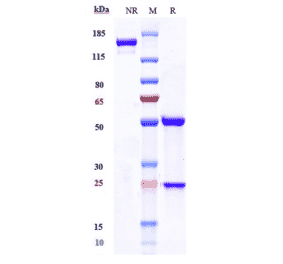 SDS-PAGE - Selicrelumab Biosimilar - Anti-CD40 Antibody - Low endotoxin, Azide free (A323725) - Antibodies.com