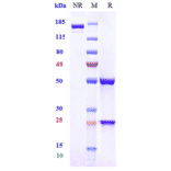 SDS-PAGE - Sibeprenlimab Biosimilar - Anti-APRIL/TNFSF13 Antibody - Low endotoxin, Azide free (A323733) - Antibodies.com