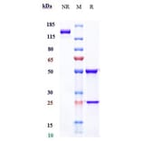 SDS-PAGE - Sifalimumab Biosimilar - Anti-Interferon alpha 1 Antibody - Low endotoxin, Azide free (A323735) - Antibodies.com