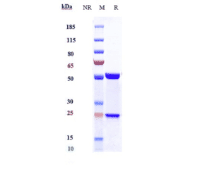 SDS-PAGE - Siltuximab Biosimilar - Anti-IL-6 Antibody - Low endotoxin, Azide free (A323736) - Antibodies.com