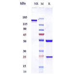 SDS-PAGE - Sintilimab Biosimilar - Anti-PD1 Antibody - Low endotoxin, Azide free (A323738) - Antibodies.com