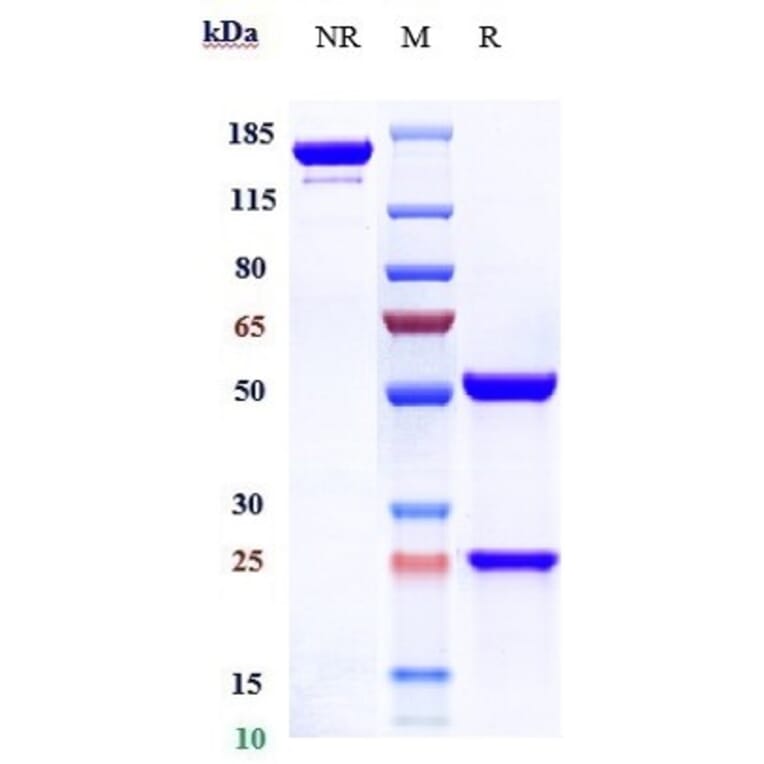 SDS-PAGE - Siplizumab Biosimilar - Anti-CD2 Antibody - Low endotoxin, Azide free (A323739) - Antibodies.com