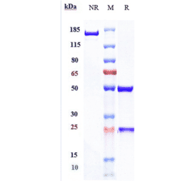 SDS-PAGE - Spartalizumab Biosimilar - Anti-PD1 Antibody - Low endotoxin, Azide free (A323748) - Antibodies.com