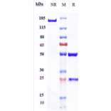 SDS-PAGE - Spartalizumab Biosimilar - Anti-PD1 Antibody - Low endotoxin, Azide free (A323748) - Antibodies.com