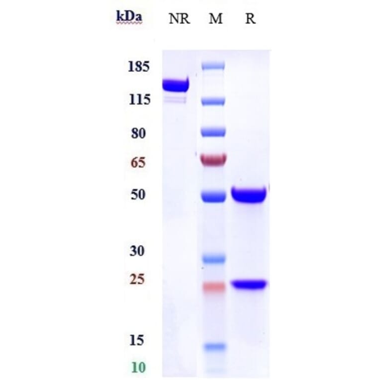 SDS-PAGE - Spesolimab Biosimilar - Anti-IL-36R Antibody - Low endotoxin, Azide free (A323749) - Antibodies.com