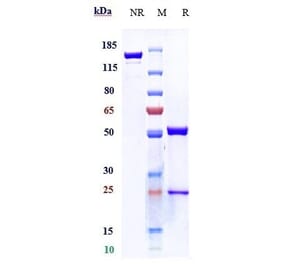 SDS-PAGE - Tabalumab Biosimilar - Anti-BAFF Antibody - Low endotoxin, Azide free (A323753) - Antibodies.com