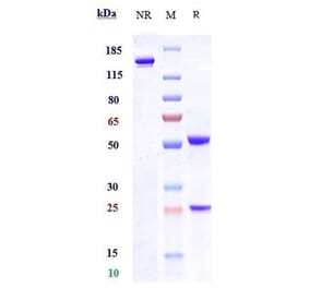 SDS-PAGE - Tamrintamab Biosimilar - Anti-DPEP3 Antibody - Low endotoxin, Azide free (A323763) - Antibodies.com