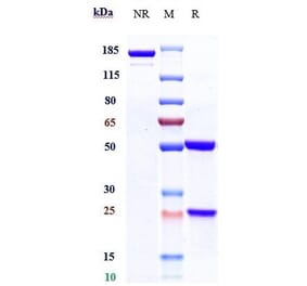 SDS-PAGE - Telisotuzumab Biosimilar - Anti-Met (c-Met) Antibody - Low endotoxin, Azide free (A323770) - Antibodies.com