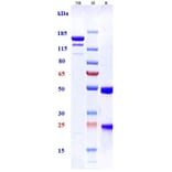 SDS-PAGE - Tesidolumab Biosimilar - Anti-C5 Antibody - Low endotoxin, Azide free (A323775) - Antibodies.com