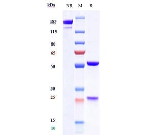 SDS-PAGE - Tezepelumab Biosimilar - Anti-TSLP Antibody - Low endotoxin, Azide free (A323777) - Antibodies.com