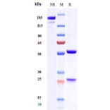 SDS-PAGE - Tezepelumab Biosimilar - Anti-TSLP Antibody - Low endotoxin, Azide free (A323777) - Antibodies.com