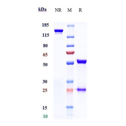SDS-PAGE - Timolumab Biosimilar - Anti-VAP1 Antibody - Low endotoxin, Azide free (A323786) - Antibodies.com
