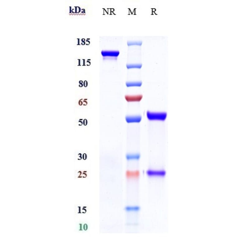 SDS-PAGE - Timolumab Biosimilar - Anti-VAP1 Antibody - Low endotoxin, Azide free (A323786) - Antibodies.com