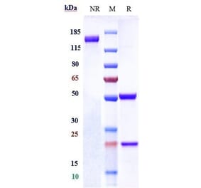 SDS-PAGE - Tinurilimab Biosimilar - Anti-CEACAM6 Antibody - Low endotoxin, Azide free (A323787) - Antibodies.com