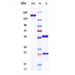 SDS-PAGE - Tiragolumab Biosimilar - Anti-TIGIT Antibody - Low endotoxin, Azide free (A323788) - Antibodies.com