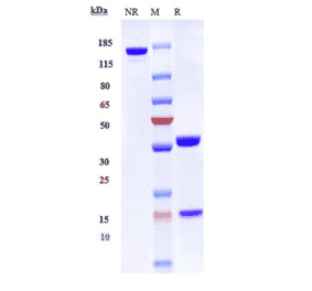 SDS-PAGE - Tislelizumab Biosimilar - Anti-PD1 Antibody - Low endotoxin, Azide free (A323789) - Antibodies.com