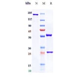 SDS-PAGE - Tomuzotuximab Biosimilar - Anti-EGFR Antibody - Low endotoxin, Azide free (A323794) - Antibodies.com