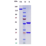 SDS-PAGE - Toripalimab Biosimilar - Anti-PD1 Antibody - Low endotoxin, Azide free (A323795) - Antibodies.com