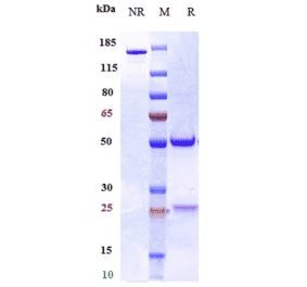 SDS-PAGE - Torudokimab Biosimilar - Anti-IL-33 Antibody - Low endotoxin, Azide free (A323796) - Antibodies.com