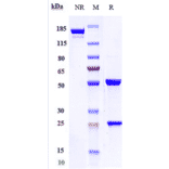 SDS-PAGE - Trastuzumab Biosimilar - Anti-ErbB2/HER2 Antibody - Low endotoxin, Azide free (A323803) - Antibodies.com