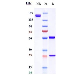 SDS-PAGE - Tregalizumab Biosimilar - Anti-CD4 Antibody - Low endotoxin, Azide free (A323804) - Antibodies.com
