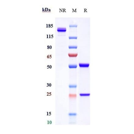 SDS-PAGE - Tregalizumab Biosimilar - Anti-CD4 Antibody - Low endotoxin, Azide free (A323804) - Antibodies.com