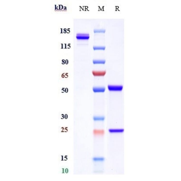 SDS-PAGE - Tregalizumab Biosimilar - Anti-CD4 Antibody - Low endotoxin, Azide free (A323804) - Antibodies.com